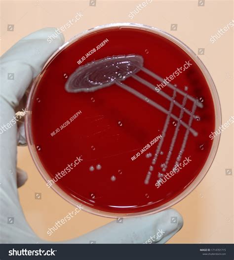 Gamma Hemolysis On Blood Agar