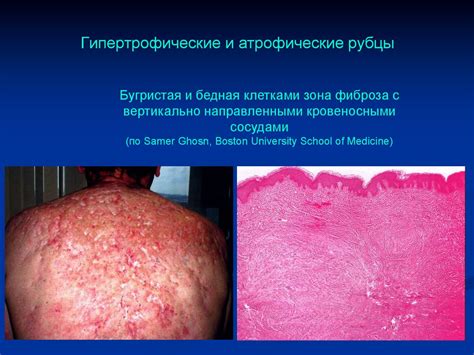 Рубцы. Этиология - презентация онлайн