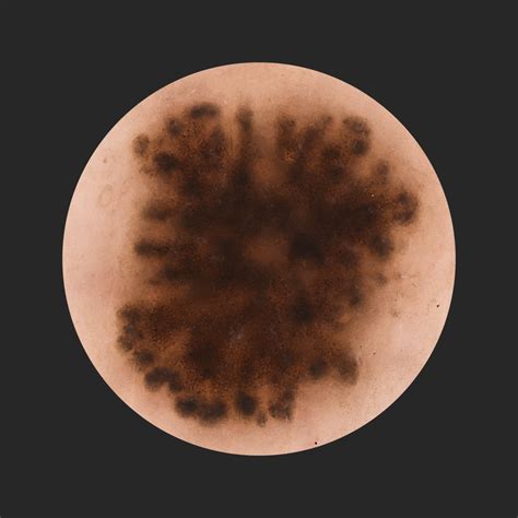 What am I looking at? A Skin-deep Secret