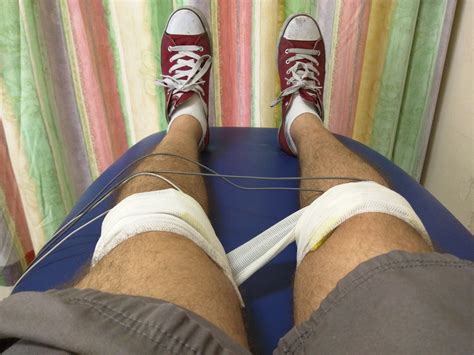 Week 2 of my physical therapy. Shock therapy is weirdly soothing : r
