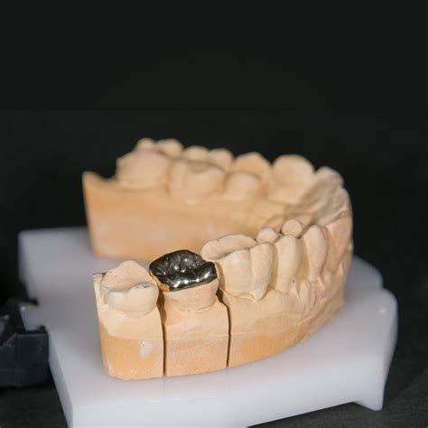 mer dental lab full cast metal cocr inlayonlay denture china full