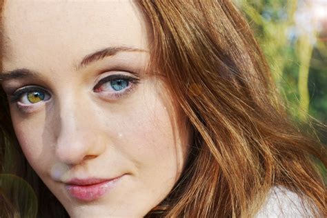 Complete Heterochromia