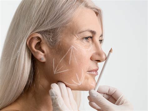 face lifting treatment tadworth kingswood aesthetics