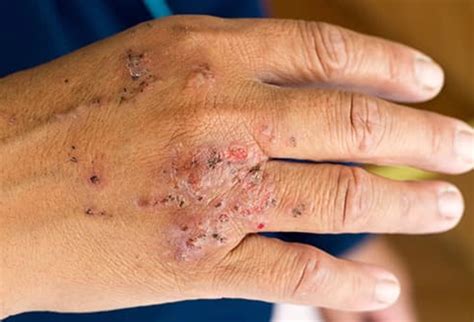 Weird Things That Happen to Your Skin as You Age