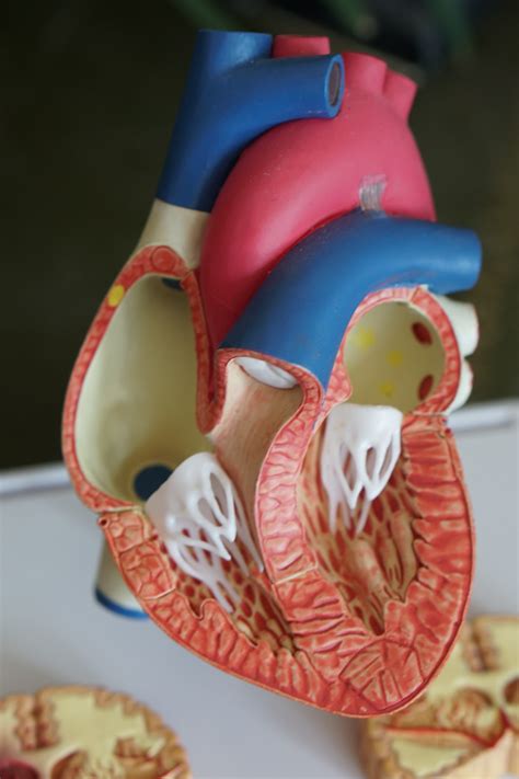 Ectopic heartbeat Archives - my afib heart