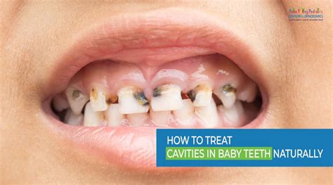 how to clean my newborn tongue