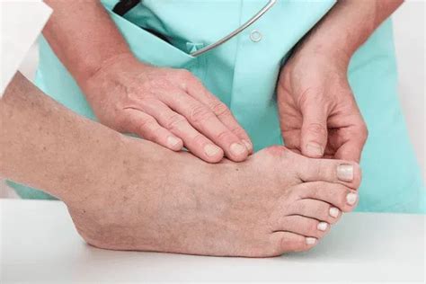 Diabetic Foot Pain: Causes And Management Strategies | Podiatry located ...