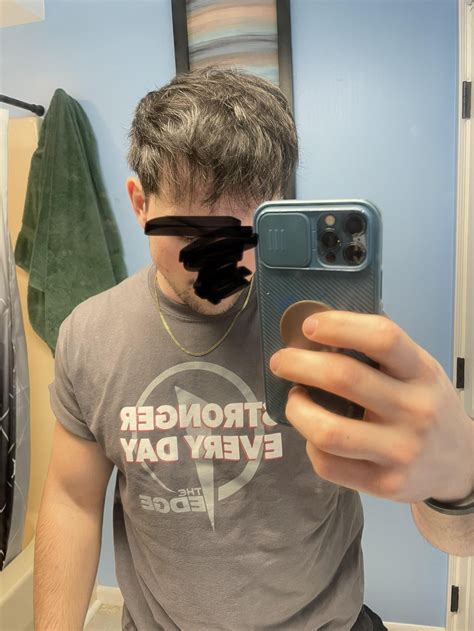 buzz cut for thinning hair 3