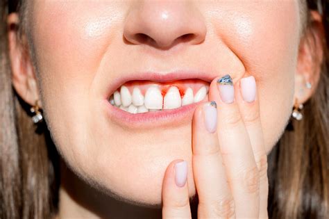 What Does Gum Disease Look Like | Peel Dental Studio Dentist Mandurah