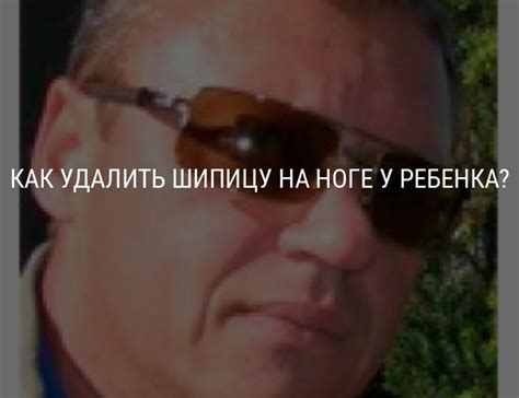 Удаление шипицы на ноге у ребенка: как удалить шипицу салиподом ...