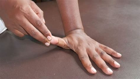 4 Effective Trigger Thumb Exercises and Tips to Ease Pain