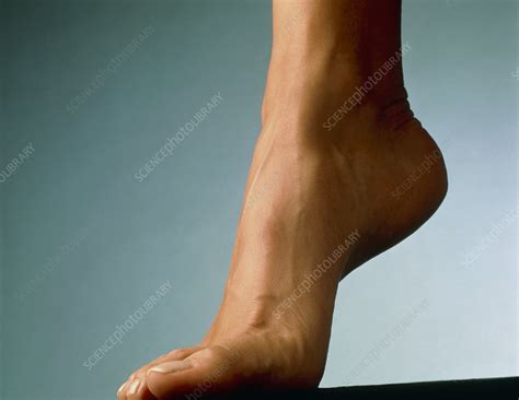 elevated foot