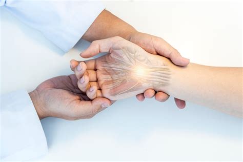 carpal tunnel benefits