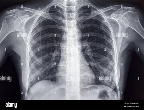 chest anatomy  res stock photography  images alamy
