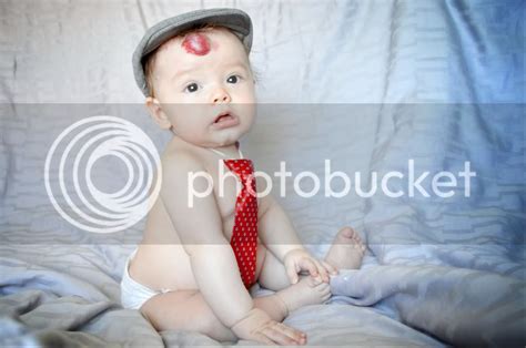 babies strawberry marks - pictures, photos