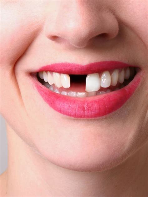 dream meaning  pulling   teeth  sarah scoop