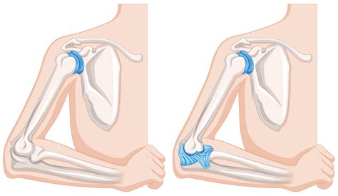 Close up diagram of human elbow joints 431658 Vector Art at Vecteezy