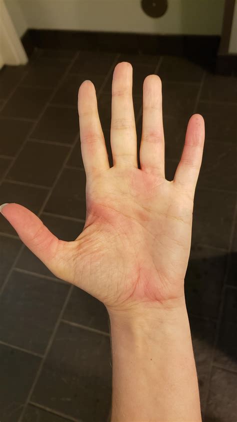 right hand itchy palm