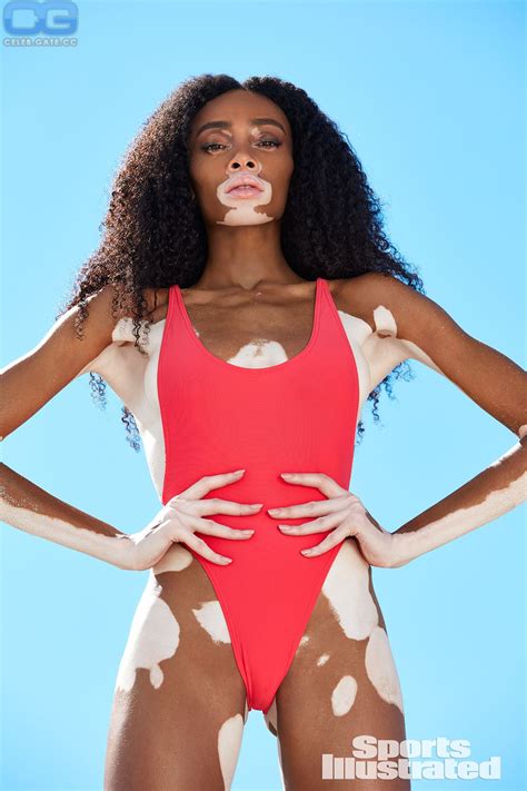 Winnie Harlow nude, pictures, photos, Playboy, naked, topless, fappening