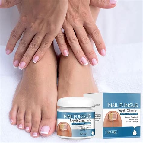 2025 New Fungal Nail Removal Cream Onychomycosis, Fungal Nail Care