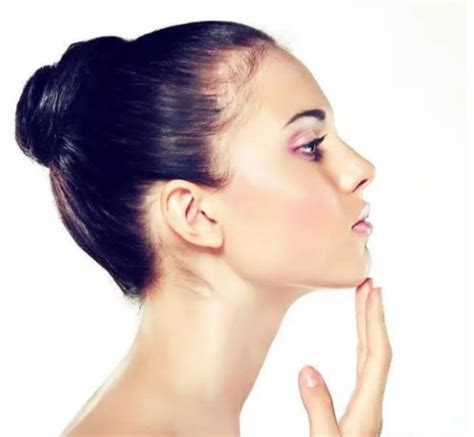 Five ways to achieve that perfect, chiseled jawline