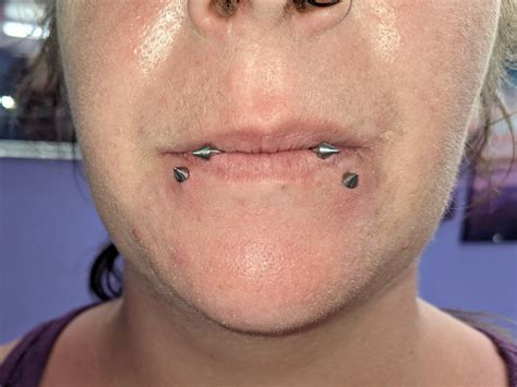 how to snake biting naturally 1