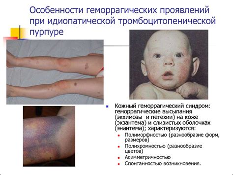 Геморрагические диатезы - презентация онлайн