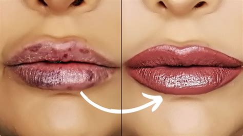 What Gets Rid Of Bruised Lips | Lipstutorial.org