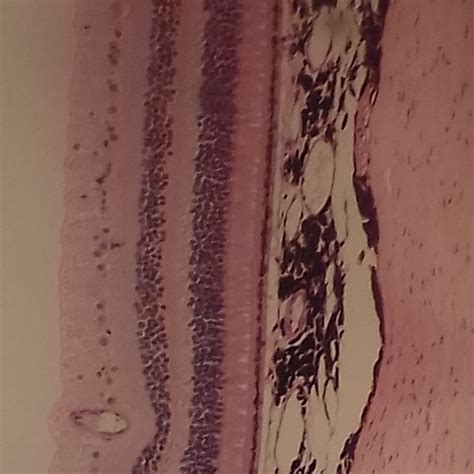 eye retina layers diagram quizlet