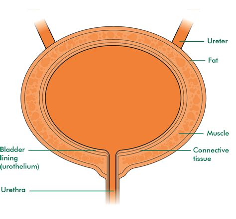 bladder cancer macmillan  community