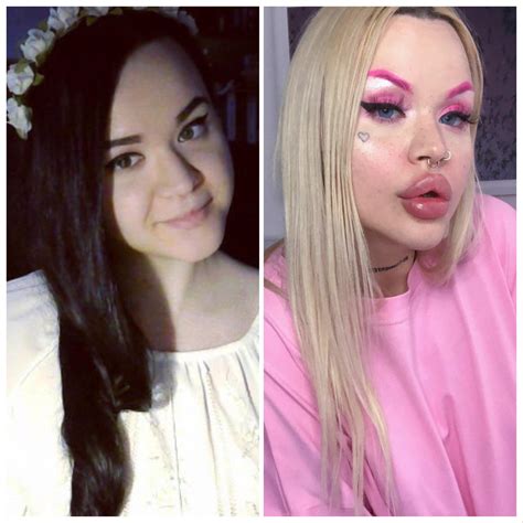 I just follow my own beauty standards My first surgery is booked on