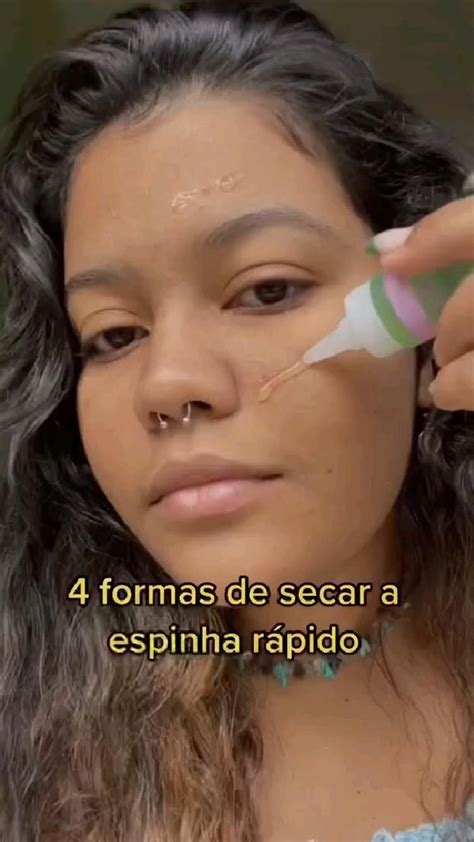 O Que Usar Para Secar Espinha - 4 FORMAS DE SECAR AS ESPINHAS RÁPIDO | Produtos de cuidados para a pele ...