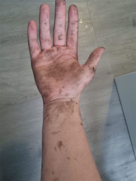 Kaltwachs Reste Von Haut Entfernen Hausmittel 5