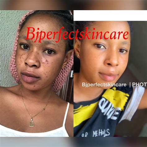 BJ Perfect Skin Care | Lagos