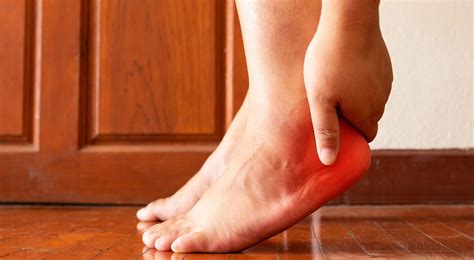 plantar fasciitis physical therapy  motion oc