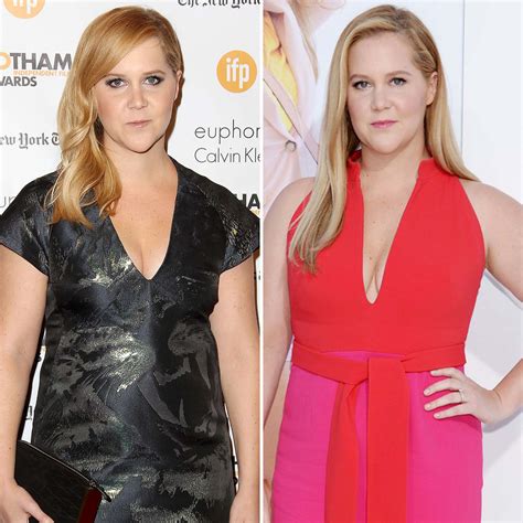 Celebrities Before And After Plastic Surgery