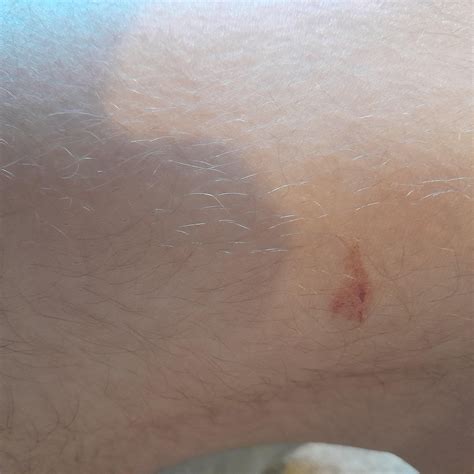 Here we have my knee after being stabbed 15 times by a math tool : r