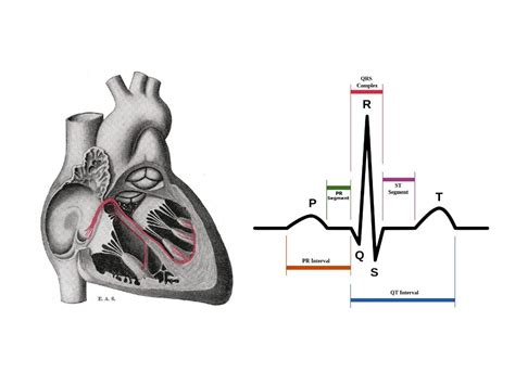 ECG Lecture: Sinus arrest, sinoatrial exit block, AV block and escape…