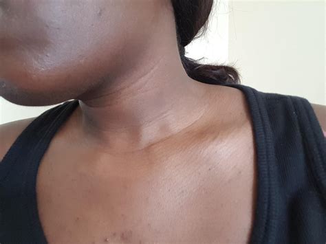 [Skin Concerns] My face and neck is darker than my chest, what products