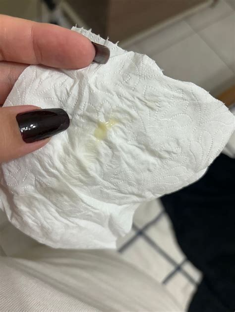 Catarro Amarelo Em Bebe - Corrimento Amarelo Espesso 13 semanas tipo “catarro”. Alguém teve ...