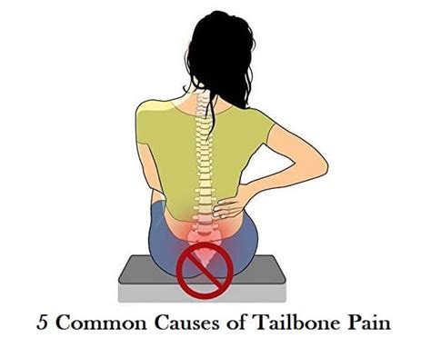 5 Common Causes of Tailbone Pain