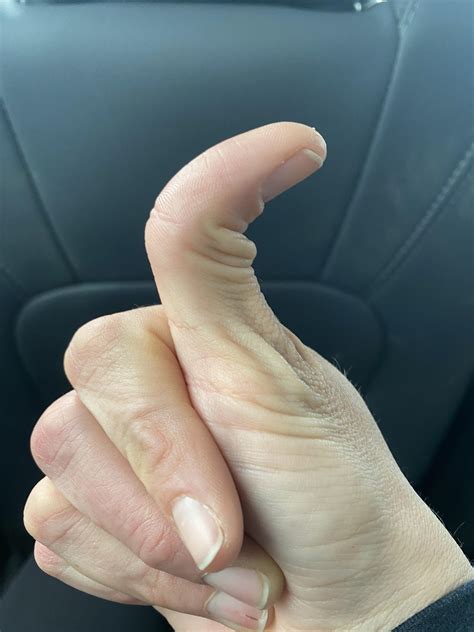 my double jointed thumb makes it really hard to snap : r/mildlyinteresting