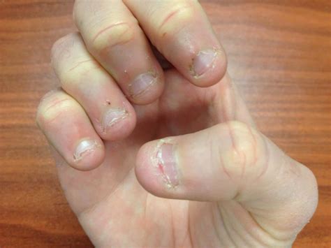 What Does Nails Contain at Sandra Willis blog