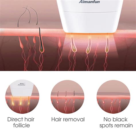 Aimanfun Flash&Go Pro Hair Removal Device-IPL