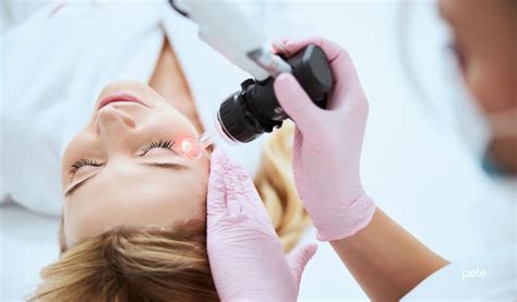 tips  choosing  dermatologist editorialge