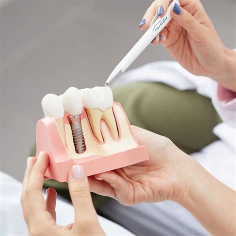 How Much Do Clear Choice Dental Implants Cost for Dental Clinics