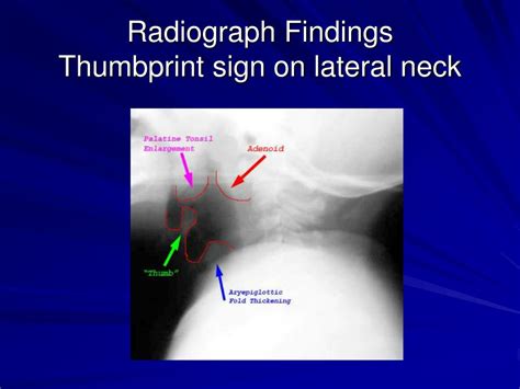 pediatric radiology powerpoint    id