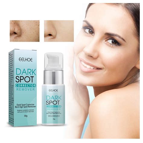Dark Spot Remover Cream for Hyperpigmentation Nepal | Ubuy