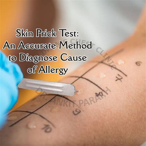 Skin Prick Test (SPT) | Accurate SPT Allergy Testing for Kids