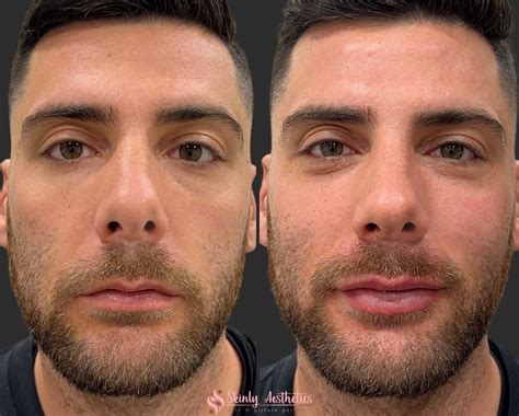 InfluencerGoneWild's Inspirational Before & After: You Can Do It Too! Image 17